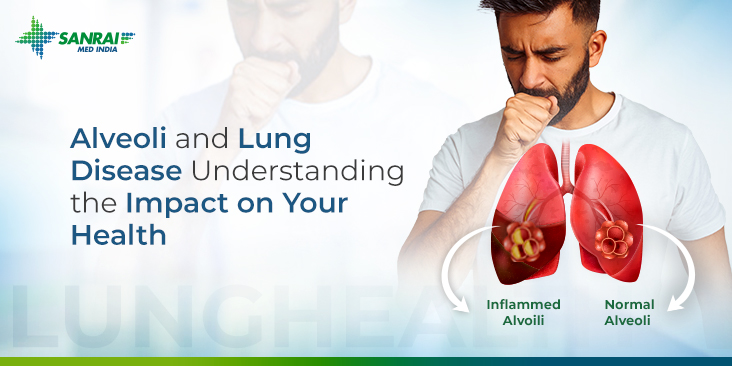 Alveoli and Lung Disease: Understanding the Impact on Your Health